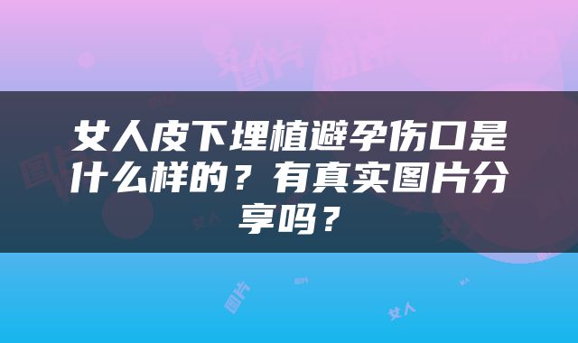女人皮下埋植避孕伤口是什么样的？有真实图片分享吗？