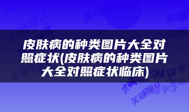 皮肤病的种类图片大全对照症状(皮肤病的种类图片大全对照症状临床)