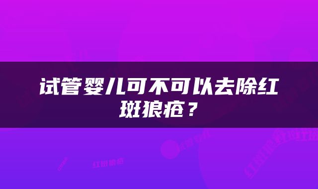 试管婴儿可不可以去除红斑狼疮？