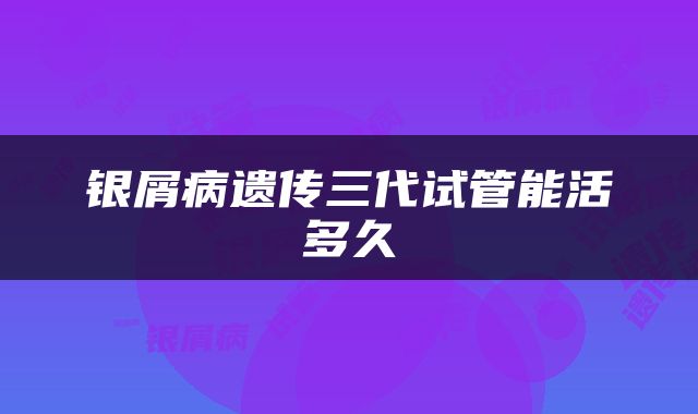银屑病遗传三代试管能活多久