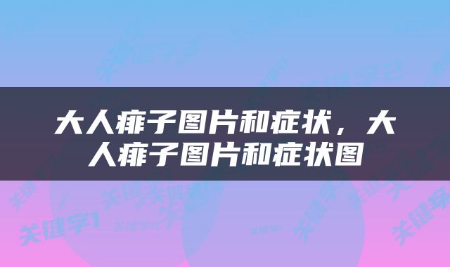 大人痱子图片和症状，大人痱子图片和症状图
