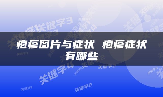 疱疹图片与症状 疱疹症状有哪些