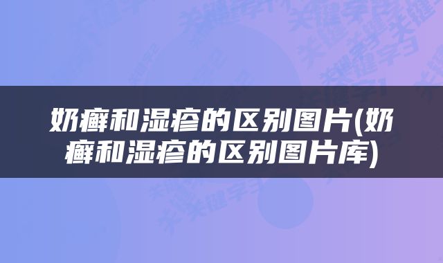 奶癣和湿疹的区别图片(奶癣和湿疹的区别图片库)