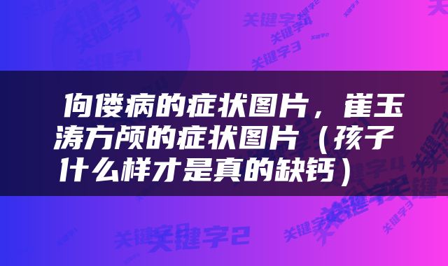  佝偻病的症状图片，崔玉涛方颅的症状图片（孩子什么样才是真的缺钙） 