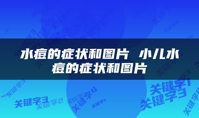 水痘的症状和图片 小儿水痘的症状和图片