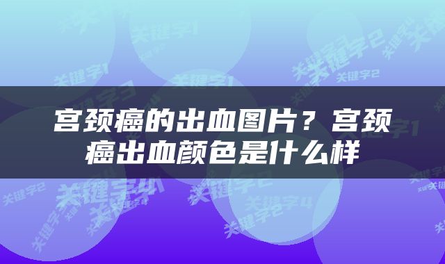 宫颈癌的出血图片？宫颈癌出血颜色是什么样