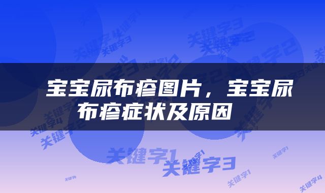  宝宝尿布疹图片，宝宝尿布疹症状及原因 