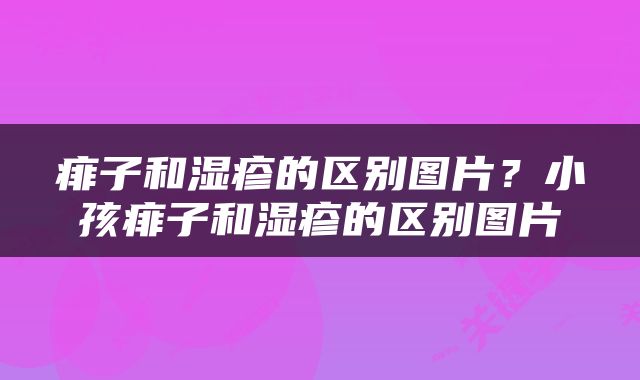 痱子和湿疹的区别图片？小孩痱子和湿疹的区别图片