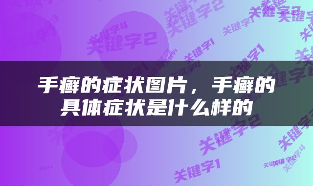 手癣的症状图片，手癣的具体症状是什么样的