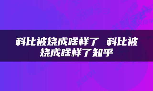 科比被烧成啥样了 科比被烧成啥样了知乎