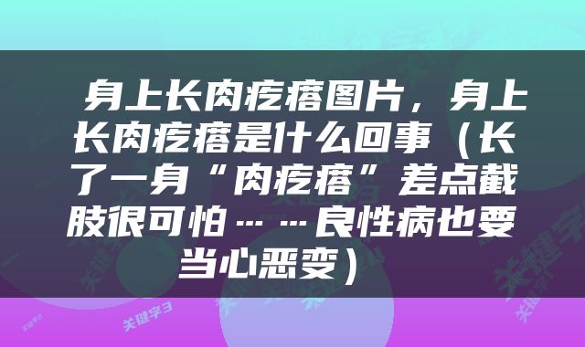  身上长肉疙瘩图片，身上长肉疙瘩是什么回事（长了一身“肉疙瘩”差点截肢很可怕……良性病也要当心恶变） 