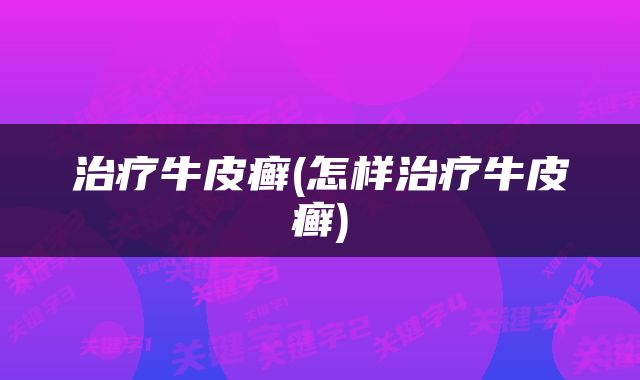 治疗牛皮癣(怎样治疗牛皮癣)