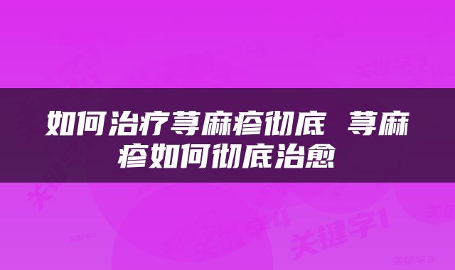 如何治疗荨麻疹彻底 荨麻疹如何彻底治愈