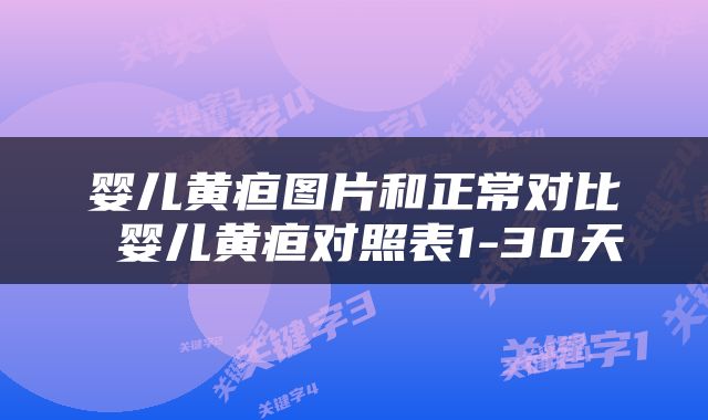 婴儿黄疸图片和正常对比 婴儿黄疸对照表1-30天