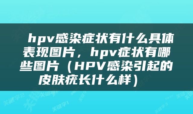  hpv感染症状有什么具体表现图片，hpv症状有哪些图片（HPV感染引起的皮肤疣长什么样） 