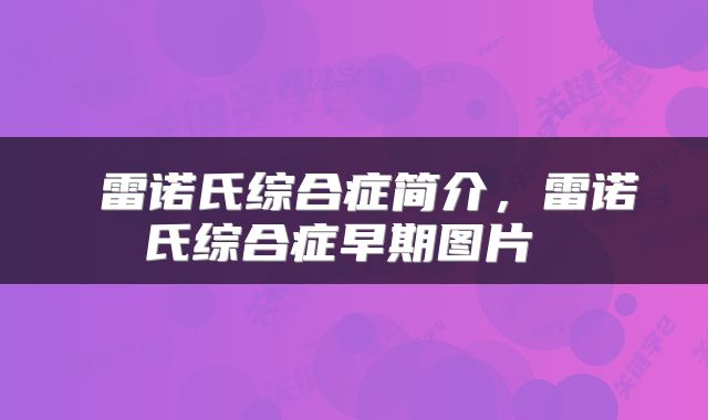  雷诺氏综合症简介，雷诺氏综合症早期图片 