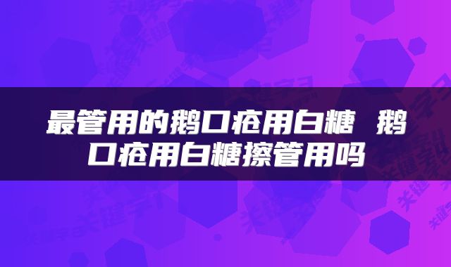 最管用的鹅口疮用白糖 鹅口疮用白糖擦管用吗