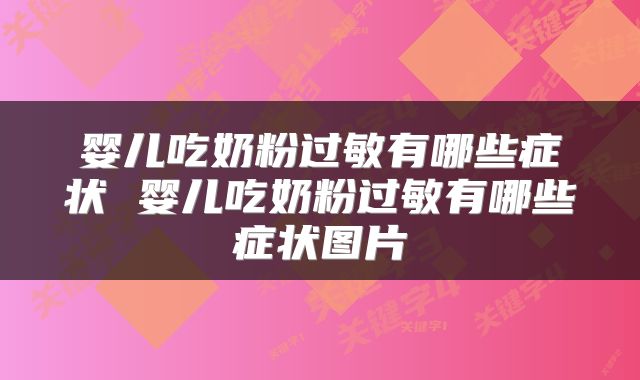 婴儿吃奶粉过敏有哪些症状 婴儿吃奶粉过敏有哪些症状图片