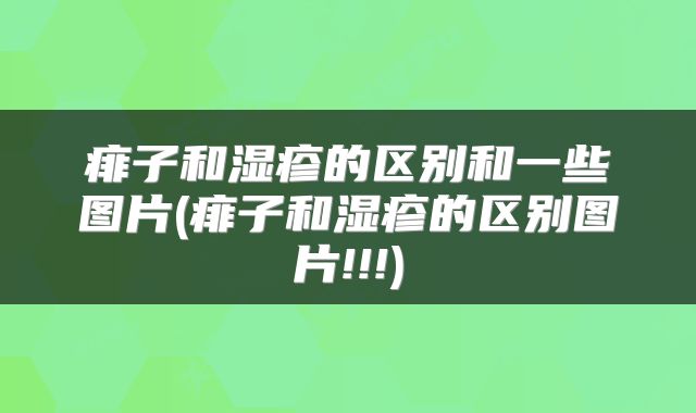 痱子和湿疹的区别和一些图片(痱子和湿疹的区别图片!!!)