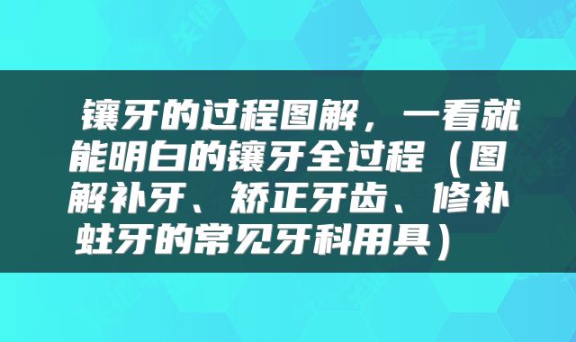 镶牙的过程图解,一看就能明白的镶牙全过程(图解补牙、矫正牙齿、修补蛀牙的常见牙科用具)